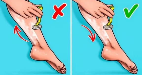How to Get Rid of Strawberry Legs